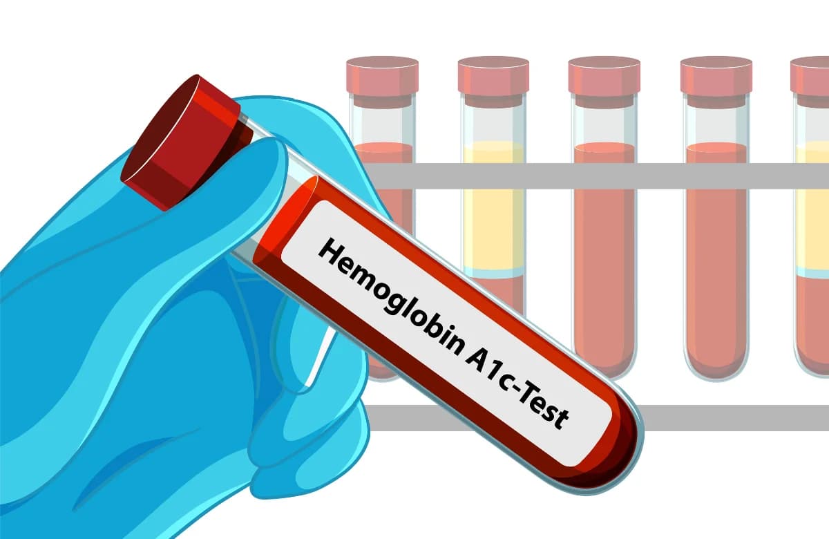“METABOLİK YÜKÜNÜZ” BU TESTTE GİZLİ
